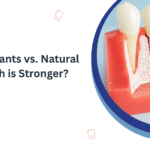 Dental Implants vs. Natural Teeth Which is Stronger