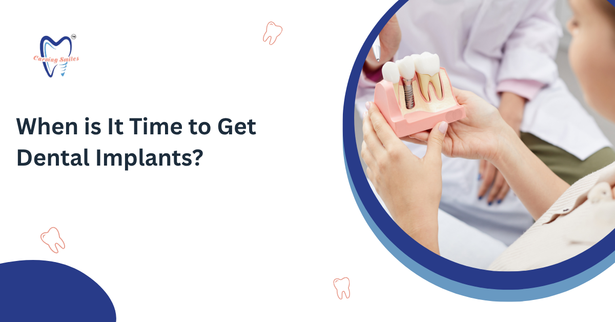 When is It Time to Get Dental Implants?