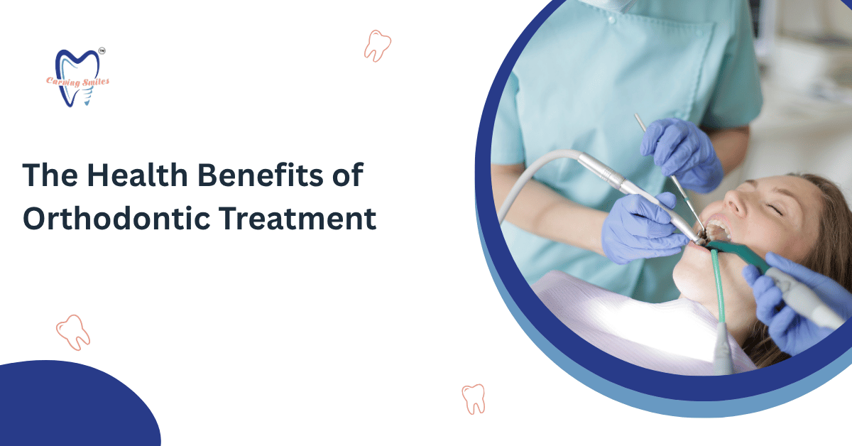The Health Benefits of Orthodontic Treatment