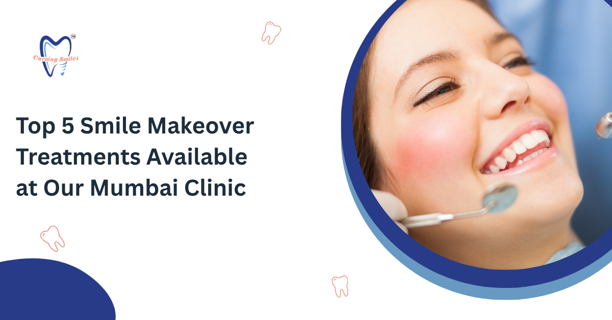 Top 5 Smile Makeover Treatments Available at Our Mumbai Clinic
