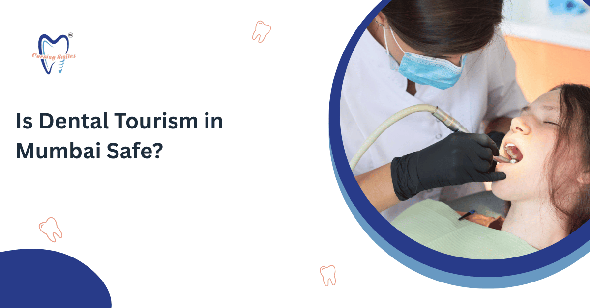 Is Dental Tourism in Mumbai Safe?