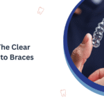 Invisalign: The Clear Alternative to Braces