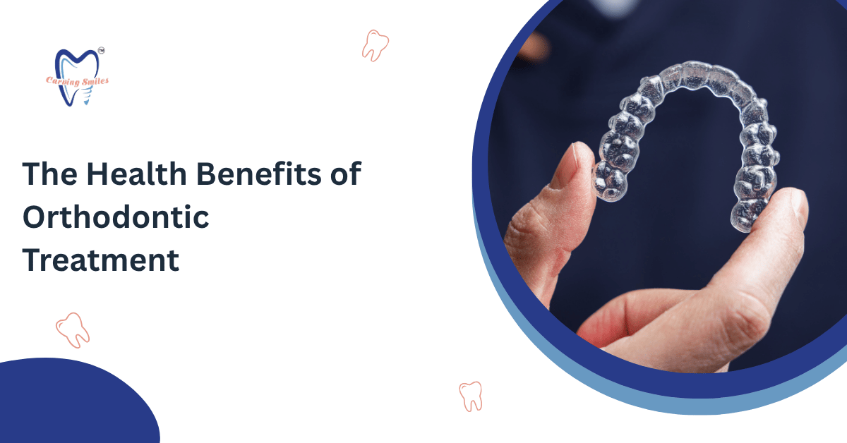 Benefits of Invisalign