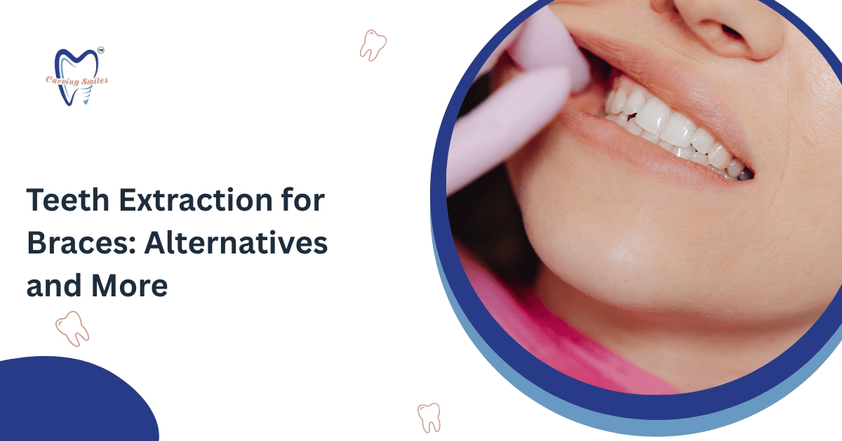 Teeth Extraction for Braces: Alternatives and More