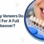 How Many Veneers Do You Need For A Full Smile Makeover?