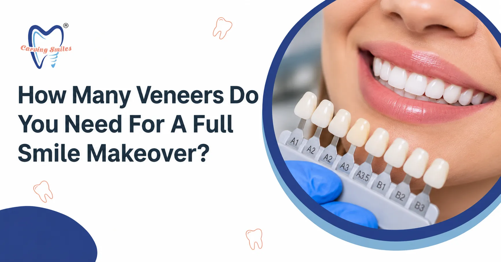 How Many Veneers Do You Need For A Full Smile Makeover?