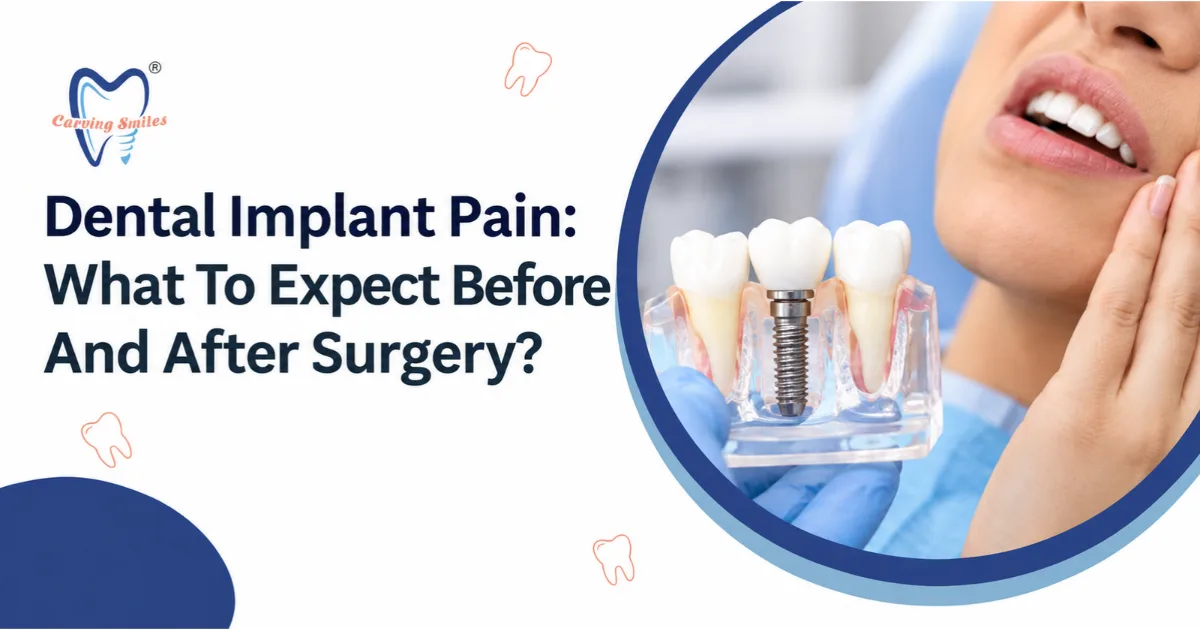 Dental Implant Pain: What To Expect Before And After Surgery?