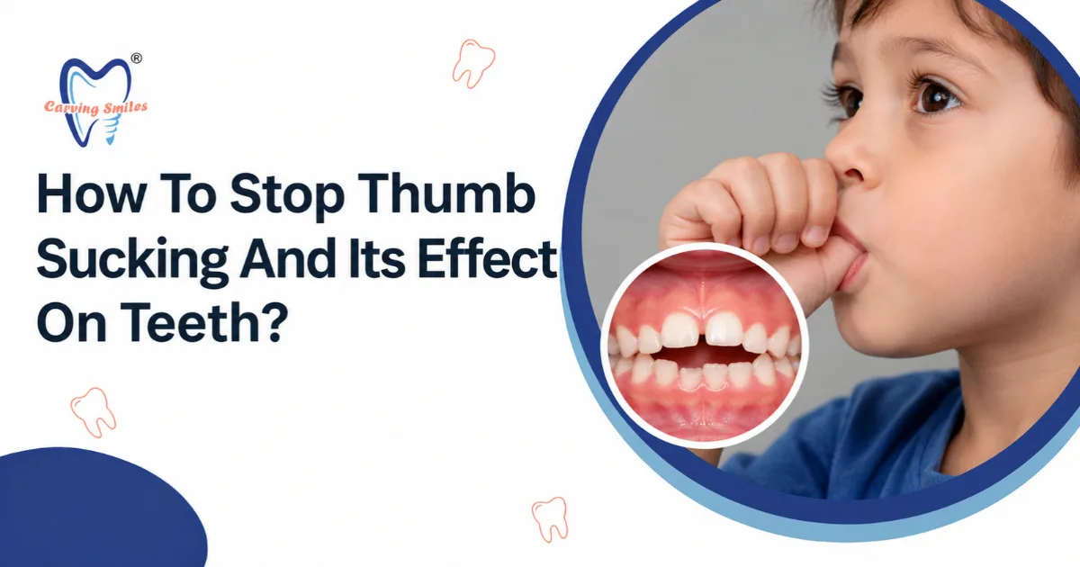 How To Stop Thumb Sucking And Its Effect On Teeth?